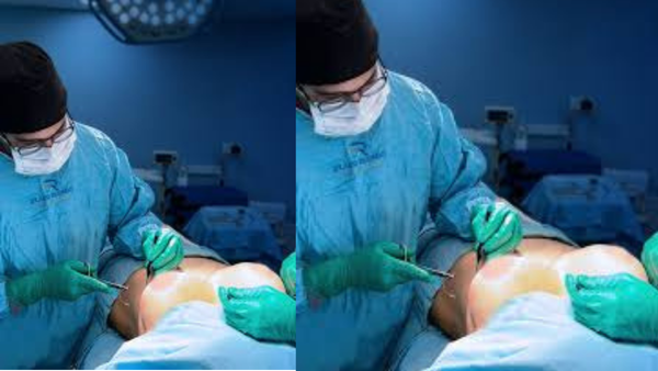  Joven médico puertoplateño realizó cirugías gratuitas de reducción de mamas a pacientes con gigantomastia  