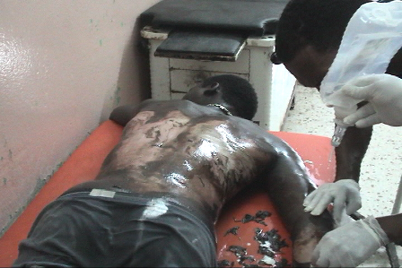 NACIONALES HAITIANOS ESCENIFICAN RIÑAS; LANZAN ACEITE CALIENTE A COMPATRIOTA