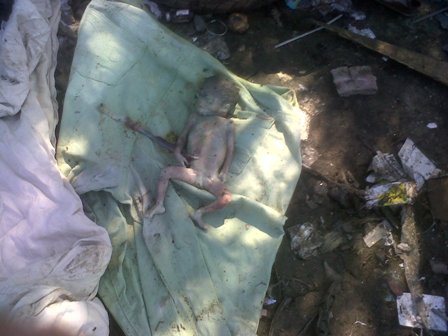 Hallan feto vertedero municipal Puerto Plata