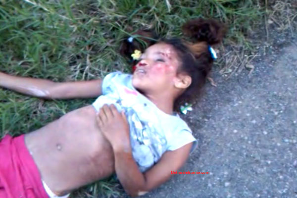 Mueren dos menores atropellados por camión y motocicleta