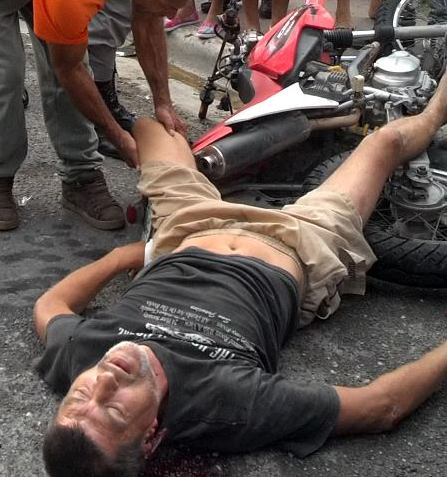 Ciudadano extranjero resulta herido tras deslizarse la moto que conducía