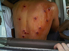 Patrulla policial hiere uno en Los Callejones; otro resulta herido en una riña