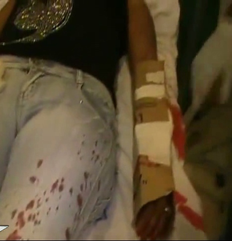Hombre celoso le corta una mano a su ex concubina en Gaspar Hernández