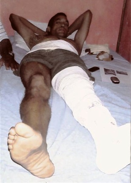 Vigilante haitiano hiere a un compatriota tras sorprenderlo robando yuca en una finca
