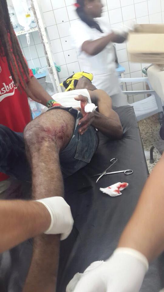 Joven es herido de un balazo en cuartel PN de Imbert cuando supuestamente intentó desarmar agente