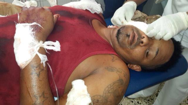 Pleito a machetazos entre dos hombres en Imbert deja un herido de gravedad