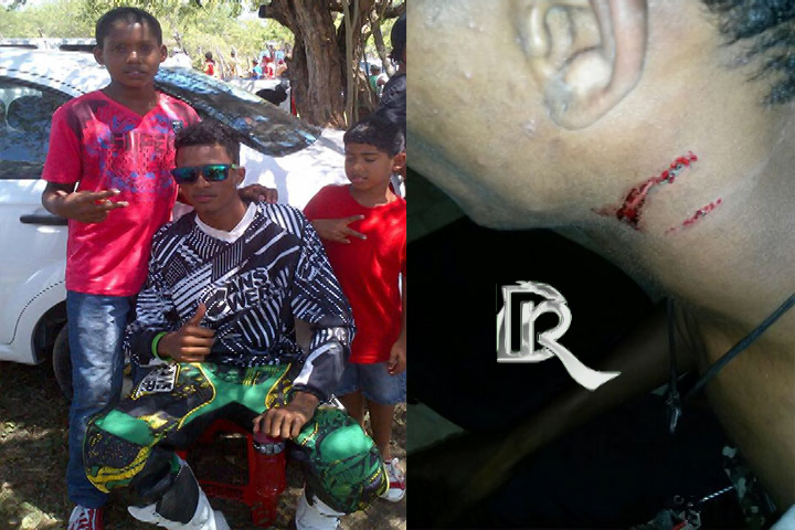 Desconocido agrede e intenta asesinar al piloto de motocrós “La Iguanita” en Sosúa