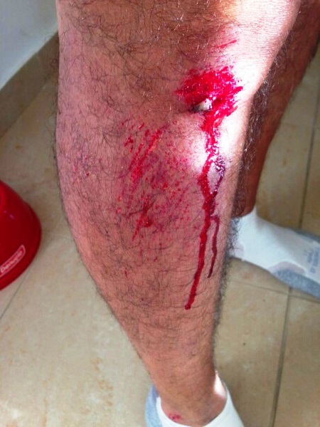 Delincuentes asaltan y golpean empresario de PP cuando se ejercitaba en el malecón