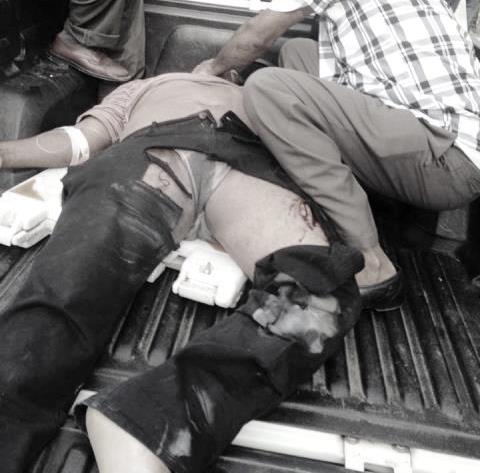 Mueren dos arrollados en accidentes de tránsito acontecidos en Imbert y Montellano