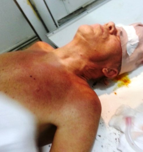 Delincuentes hieren de un balazo a ingeniero alemán para robarle en parqueo de supermercado en Puerto Plata