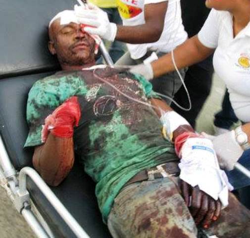 Haitiano resulta con mano cercenada y múltiples heridas al sostener pleito a machetazos con un compatriota