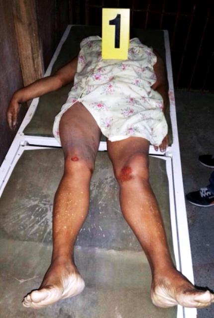 Se suicida mujer al lanzarse de puente peatonal en la entrada del sector Padre las Casas; muere alemán baleado por delincuentes