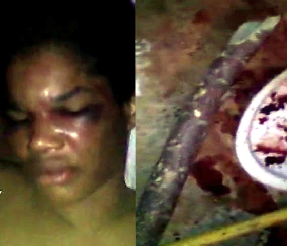  ¡Qué Salvajada!  Hombre celoso golpea de manera despiadada con un palo a su concubina en Cabarete