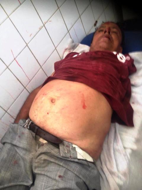 Hombre con problemas psicológicos es atropellado por un vehículo en carretera Puerto Plata- Imbert