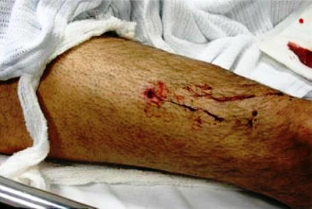 Sigue la violencia en Puerto Plata, desconocidos matan de un tiro en la cabeza a un joven haitiano