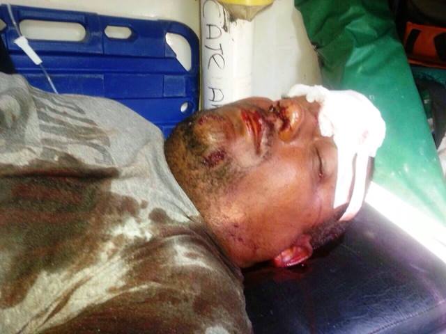 Un herido de gravedad y varios detenidos tras represión policial a protesta exigiendo carretera a cuatro carriles