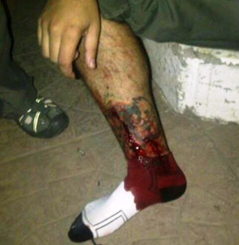 Hombre resulta herido de bala en un pie durante una riña acaecida en el sector Cristo Rey de Puerto Plata