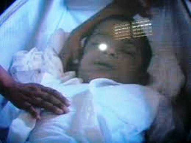Muere niño de Puerto Plata por dengue en una clínica privada de Santiago