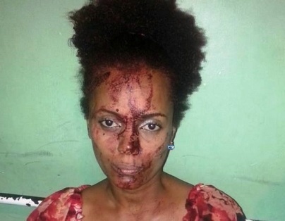 Ordenan investigar agresión policial a joven y su madre en sector de Puerto Plata