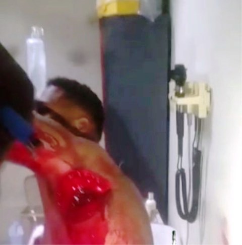 Dos jóvenes se hieren a machetazos en Cabarete por viejas rencillas personales, apresan haitiano robó celular a norteamericano