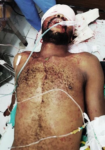 ¡Qué Tragedia! Discusión por 500 pesos entre haitiano y dominicano deja al primero muerto en Sosúa
