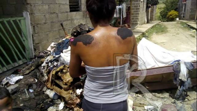 Mujer queda a la intemperie tras incendio consumir su vivienda en Sosúa, desconocidos roban motocicleta en Imbert