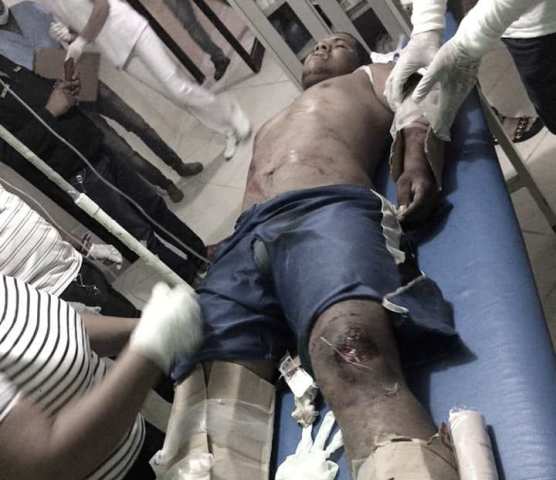 Muere joven al ser atropellado por una yipeta en Villa Isabela, sepultan en Imbert a destacado educador