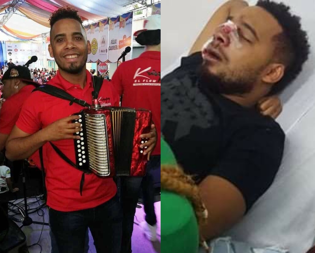 Agreden joven acordeonista en una trifulca ocurrida en Quebrada Honda de Altamira