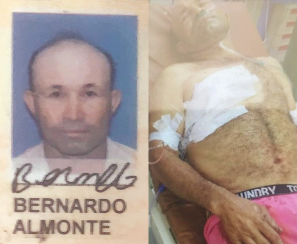 Desconocidos hieren empleado privado a balazos cuando transitaba por avenida de Puerto Plata