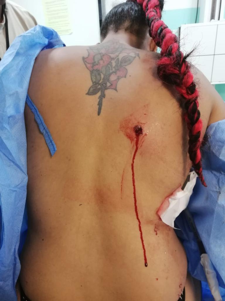 Hieren mujer de un balazo en la espalda durante trifulca en El Javillar