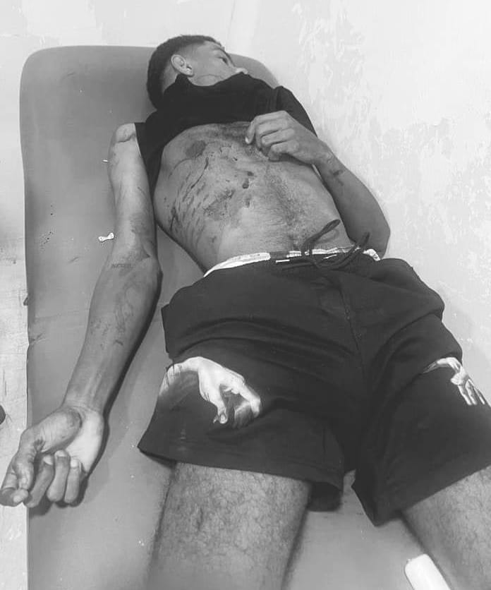 Cae abatido por la Policía en Santiago uno de los dos asaltantes que asesinaron joven en Puerto Plata