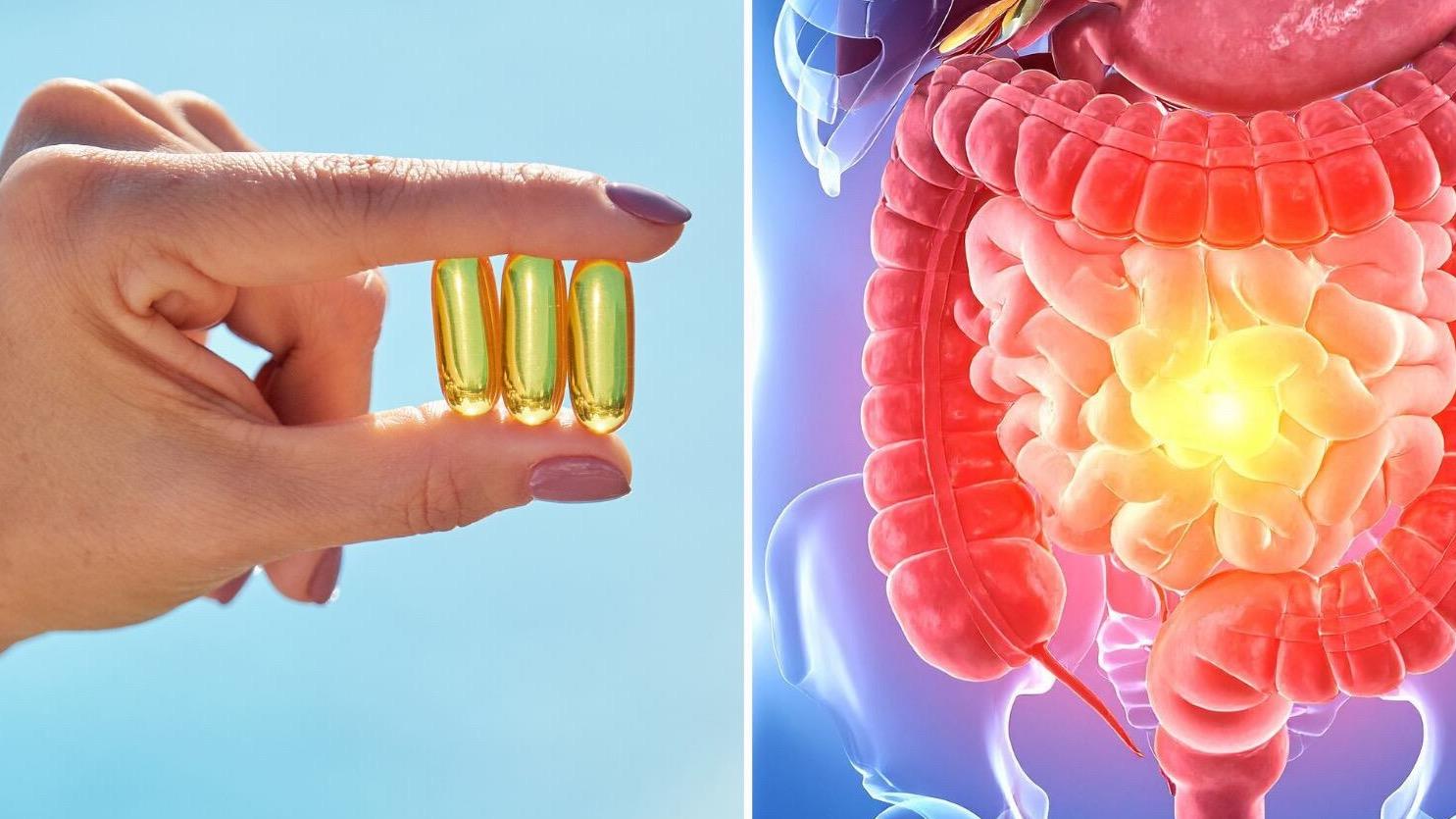 La vitamina D podría ayudar a regular la respuesta inmunitaria en personas con enfermedad inflamatoria intestinal