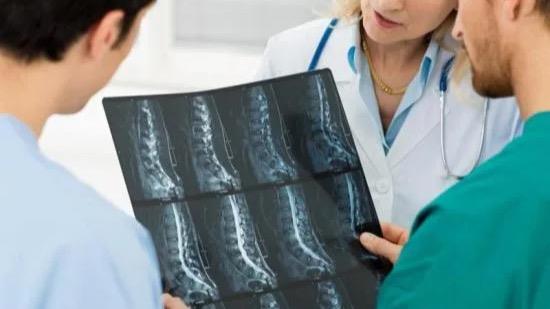 ¿Un tumor óseo siempre significa cáncer? Esto es lo que hay que saber